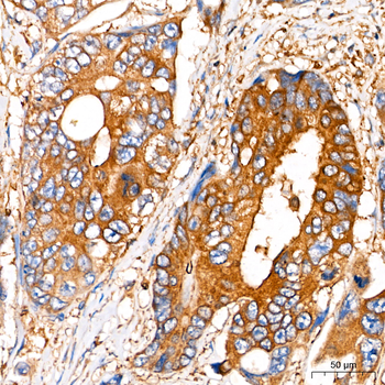 [KO Validated] Insulin-degrading enzyme (IDE) Rabbit pAb
