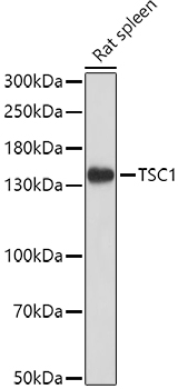 TSC1 Rabbit pAb