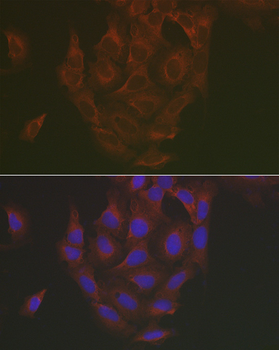 [KO Validated] Caspase-3 Rabbit pAb