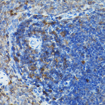 [KO Validated] Caspase-3 Rabbit pAb