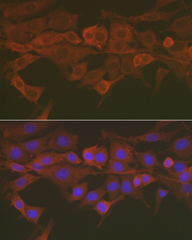 [KO Validated] Caspase-3 Rabbit pAb