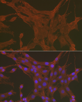 [KO Validated] Caspase-3 Rabbit pAb