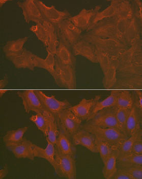 [KO Validated] Caspase-3 Rabbit pAb
