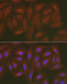 [KO Validated] Caspase-3 Rabbit pAb