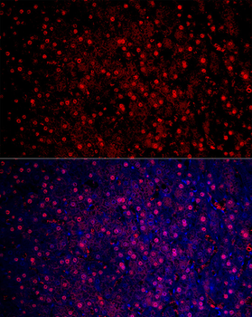 Arginase 1 (ARG1) Rabbit pAb