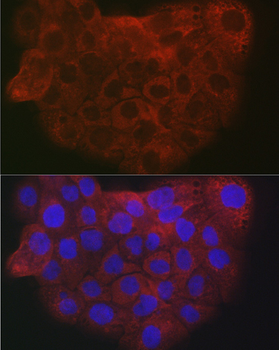 Collagen I/COL1A2 Rabbit pAb
