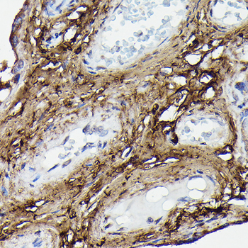 Collagen I/COL1A2 Rabbit pAb