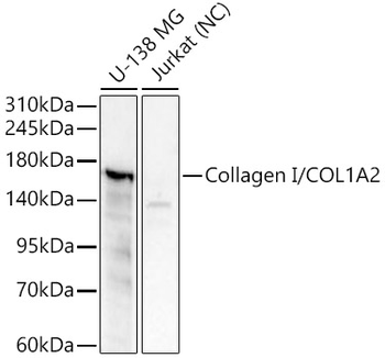 Collagen I/COL1A2 Rabbit pAb