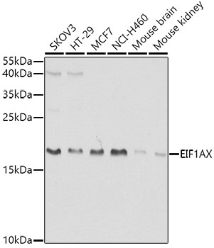 EIF1AX Rabbit pAb