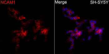 NCAM1 / CD56 Rabbit pAb