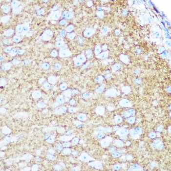 NCAM1 / CD56 Rabbit pAb