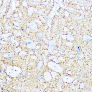 NCAM1 / CD56 Rabbit pAb