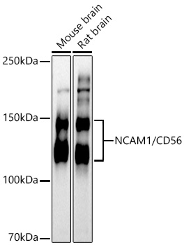 NCAM1 / CD56 Rabbit pAb