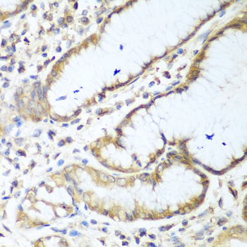 NUDT15 Rabbit pAb