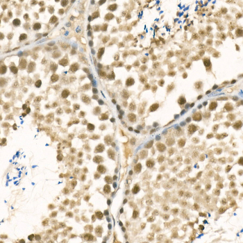 METTL3 Rabbit pAb
