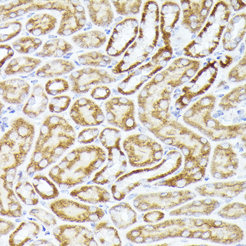 BMPR1B Rabbit pAb