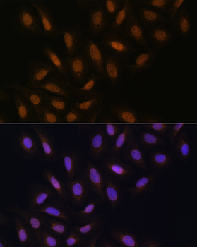 DNA polymerase eta Rabbit pAb