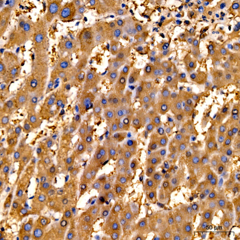 Ferritin Heavy Chain Rabbit pAb