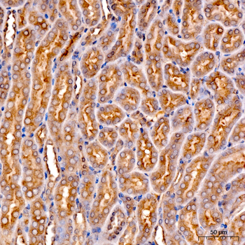 Ferritin Heavy Chain Rabbit pAb
