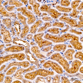 Ferritin Heavy Chain Rabbit pAb