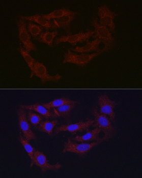 Ferritin Heavy Chain Rabbit pAb