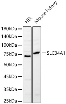 SLC34A1 Rabbit pAb