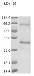 Recombinant Human Adiponectin receptor protein 1 (ADIPOR1), partial