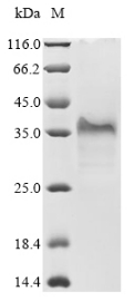 Recombinant Mouse Epithelial cell adhesion molecule (Epcam), partial