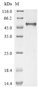 Recombinant Human Inter-alpha-trypsin inhibitor heavy chain H3 (ITIH3), partial