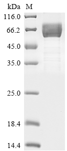 Recombinant Human Hepatitis A virus cellular receptor 2 (HAVCR2), partial