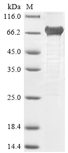 Recombinant Hepatitis E virus genotype 1 Secreted protein ORF2 (ORF2), partial