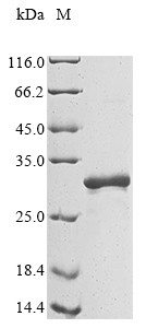 Recombinant Human Brain-derived neurotrophic factor (BDNF)