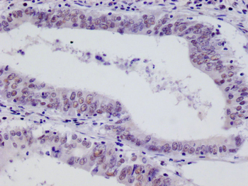 HIF1AN Antibody
