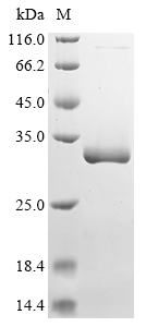 Pasteurella multocida Peptidoglycan-associated lipoprotein Protein