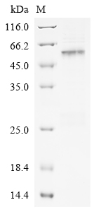 Hepatitis B virus genotype C subtype adr Capsid Protein