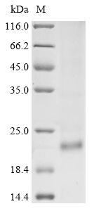 Hepatitis B virus genotype C subtype ayw Capsid Protein