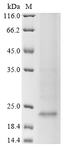 Hepatitis B virus genotype C subtype ayw Capsid Protein