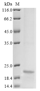 Hepatitis B virus genotype B/C subtype adw External core antigen Protein