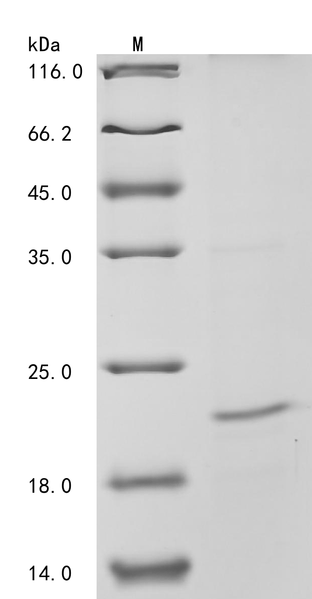 Hepatitis B virus genotype B/C subtype adw External core antigen Protein