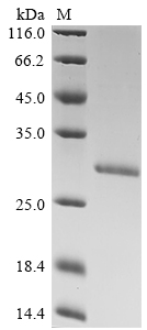 Hepatitis B virus genotype C subtype ayw Capsid Protein