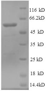 Human TUBB3 Protein