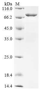 Recombinant Human ATP-dependent RNA helicase DDX19B (DDX19B)