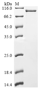 Recombinant Human Cholesteryl ester transfer protein (CETP)