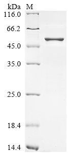 Recombinant Severe acute respiratory syndrome coronavirus 2 Nucleoprotein (N) (P13L,Δ31-33,P151S,R203K,G204R,S413R), partial