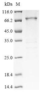 Recombinant Hepatitis B virus genotype C subtype ayr External core antigen (C), Biotinylated