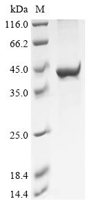 Recombinant Klebsiella pneumoniae Phosphoethanolamine--lipid A transferase MCR-8.1 (mcr-8), partial