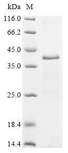 Recombinant Hepatitis B virus genotype A2 subtype adw2 Large envelope protein (S)