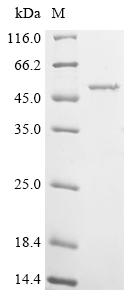 Recombinant Acinetobacter baumannii Outer membrane protein Omp38 (omp38)