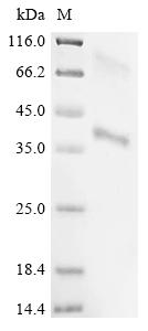 Recombinant Hepatitis B virus genotype D subtype ayw Large envelope protein (S)