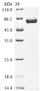 Recombinant Human Insulin-like growth factor-binding protein 7 (IGFBP7) (Active)